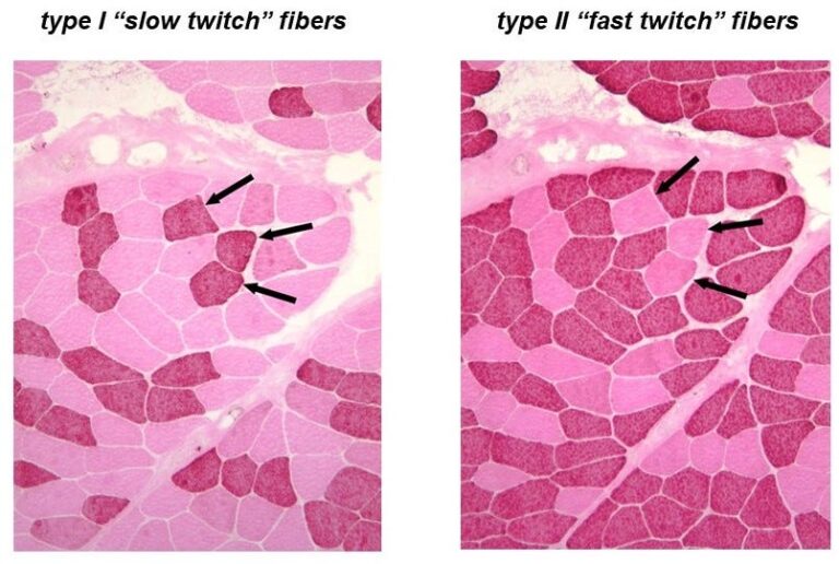 amonijak u sportu Tip 2x vlakna brza mišićna vlakna purinski nukleotidni ciklus centralni umor medicina sporta biomehanika plivanja kreatin fosfat hiperamonemija RFD brzina sile